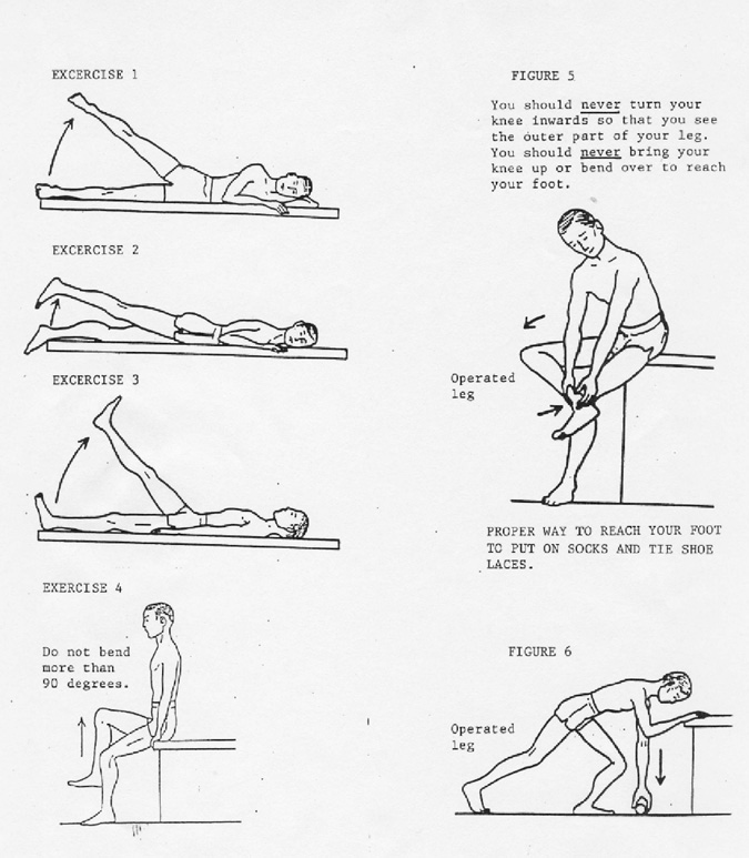 Hip Replacement Exercises After 8 Weeks Exercise